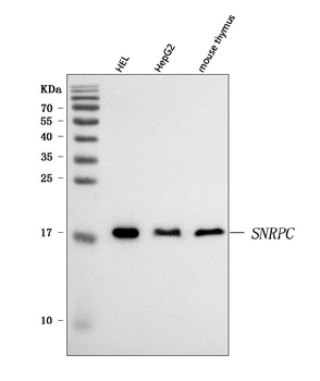 U1-C/SNRPC/U1 Rabbit Polyclonal Antibody