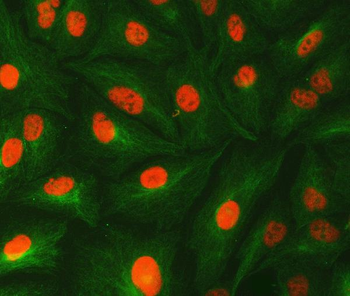 U1-C/SNRPC/U1 Rabbit Polyclonal Antibody