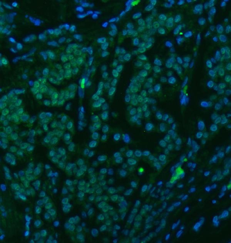 U1-C/SNRPC/U1 Rabbit Polyclonal Antibody