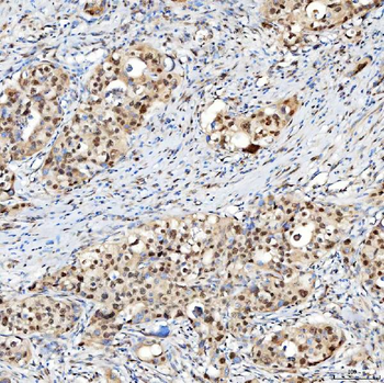 U1-C/SNRPC/U1 Rabbit Polyclonal Antibody