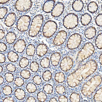 U1-C/SNRPC/U1 Rabbit Polyclonal Antibody