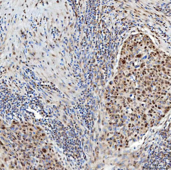 U1-C/SNRPC/U1 Rabbit Polyclonal Antibody