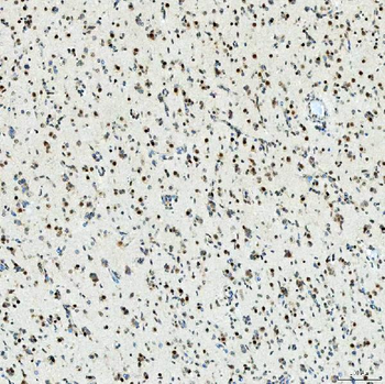 U1-C/SNRPC/U1 Rabbit Polyclonal Antibody