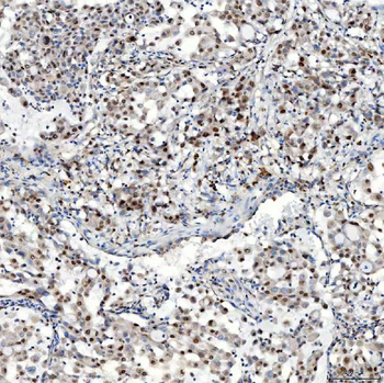 U1-C/SNRPC/U1 Rabbit Polyclonal Antibody