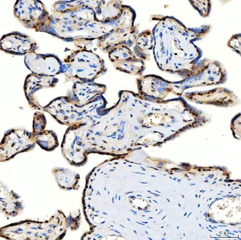 U1-C/SNRPC/U1 Rabbit Polyclonal Antibody