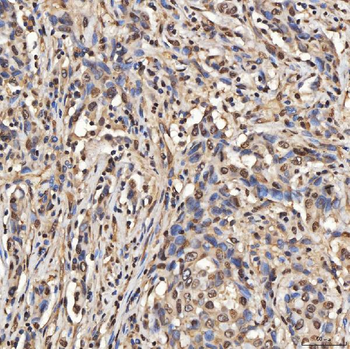 SNRPA1 Rabbit Polyclonal Antibody
