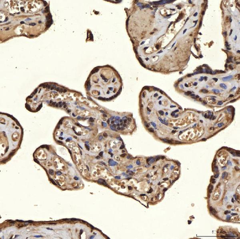 SNRPA1 Rabbit Polyclonal Antibody