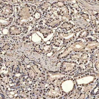 SNRPA1 Rabbit Polyclonal Antibody