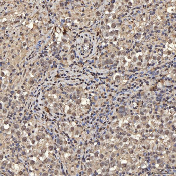 SNRPA1 Rabbit Polyclonal Antibody