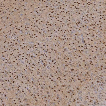 SNRPA1 Rabbit Polyclonal Antibody