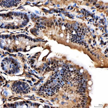 SNRPA1 Rabbit Polyclonal Antibody
