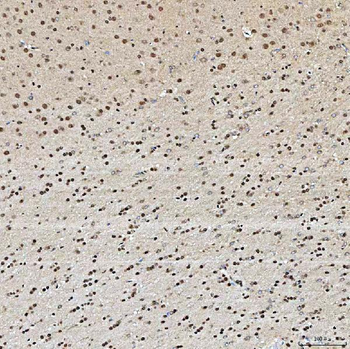 SNRPA1 Rabbit Polyclonal Antibody