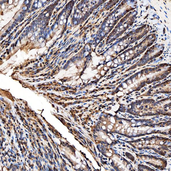 SNRPA1 Rabbit Polyclonal Antibody