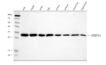 SNRPA1 Rabbit Polyclonal Antibody