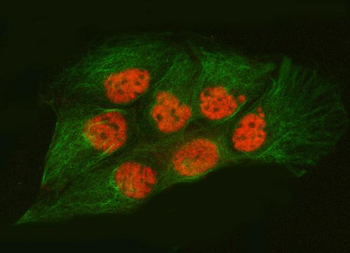 SNRPA1 Rabbit Polyclonal Antibody