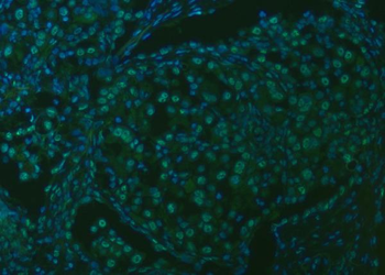 SNRPA1 Rabbit Polyclonal Antibody