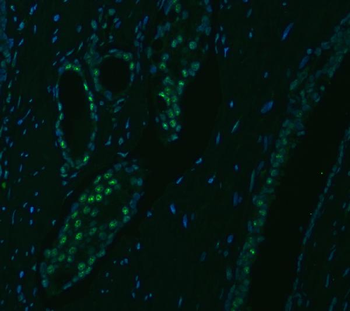 SNRPA1 Rabbit Polyclonal Antibody