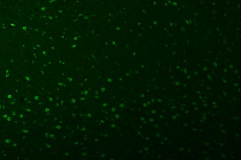 SNRPA1 Rabbit Polyclonal Antibody