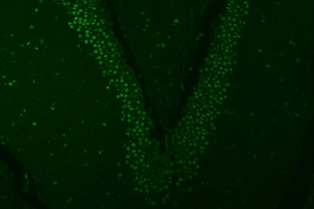 SNRPA1 Rabbit Polyclonal Antibody