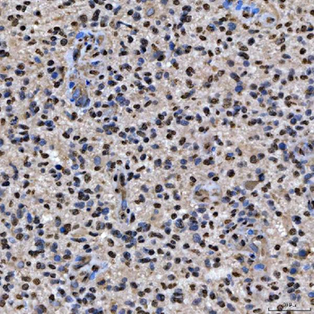 SNRPA1 Rabbit Polyclonal Antibody