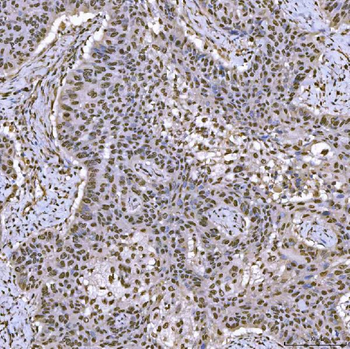 SNRPA1 Rabbit Polyclonal Antibody