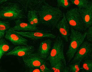 U1A/SNRPA Rabbit Polyclonal Antibody