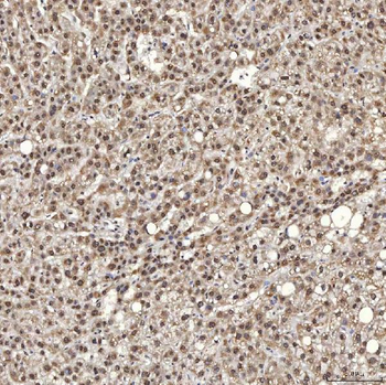 U1A/SNRPA Rabbit Polyclonal Antibody