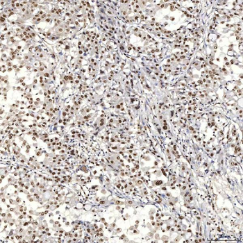 U1A/SNRPA Rabbit Polyclonal Antibody