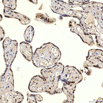 U1A/SNRPA Rabbit Polyclonal Antibody
