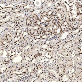U1A/SNRPA Rabbit Polyclonal Antibody