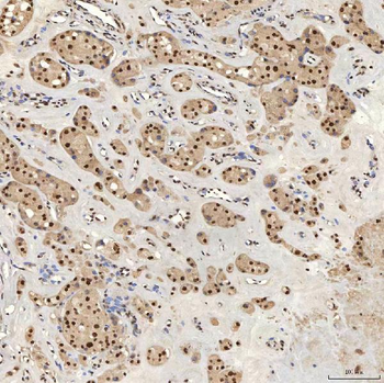 U1A/SNRPA Rabbit Polyclonal Antibody