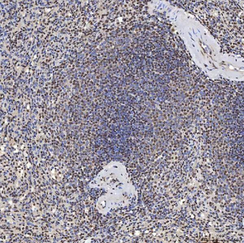 U1A/SNRPA Rabbit Polyclonal Antibody