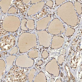 U1A/SNRPA Rabbit Polyclonal Antibody