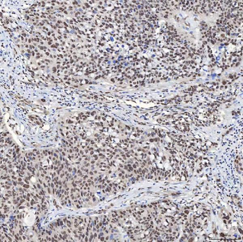 U1A/SNRPA Rabbit Polyclonal Antibody
