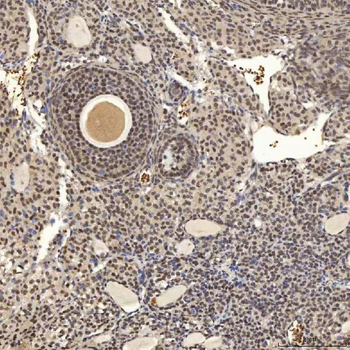 U1A/SNRPA Rabbit Polyclonal Antibody