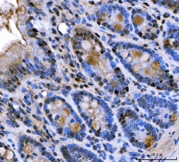 U1A/SNRPA Rabbit Polyclonal Antibody