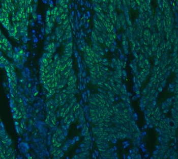 U1A/SNRPA Rabbit Polyclonal Antibody