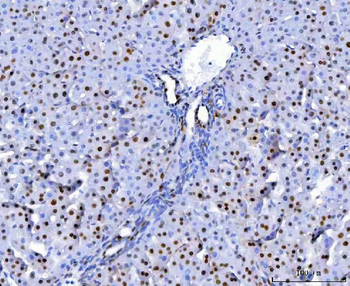 U1A/SNRPA Rabbit Polyclonal Antibody