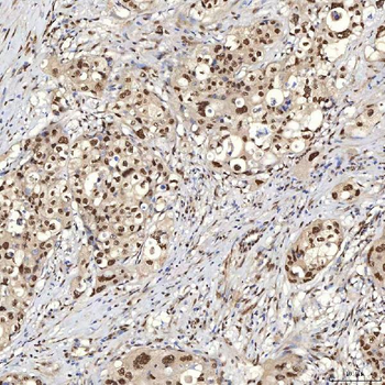 U1A/SNRPA Rabbit Polyclonal Antibody