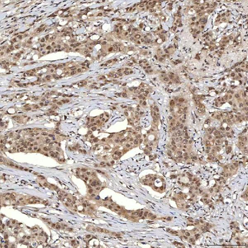 U1A/SNRPA Rabbit Polyclonal Antibody