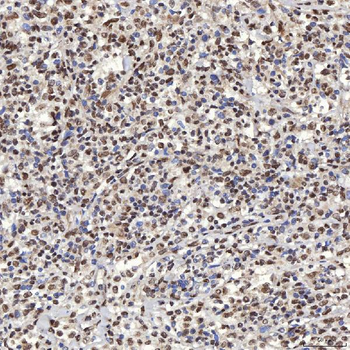 U1A/SNRPA Rabbit Polyclonal Antibody