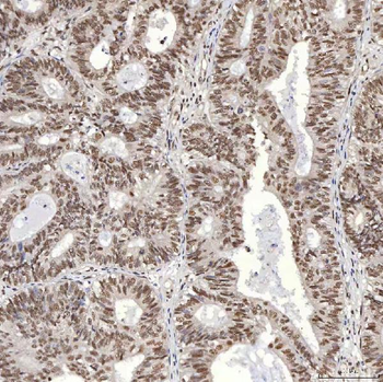 U1A/SNRPA Rabbit Polyclonal Antibody