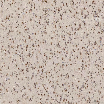 U1A/SNRPA Rabbit Polyclonal Antibody