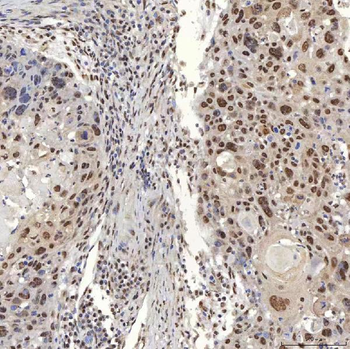 U1A/SNRPA Rabbit Polyclonal Antibody