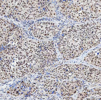 SNRNP200 Rabbit Polyclonal Antibody