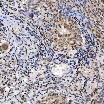 SNRNP200 Rabbit Polyclonal Antibody