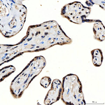 SNRNP200 Rabbit Polyclonal Antibody