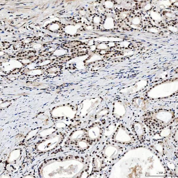 SNRNP200 Rabbit Polyclonal Antibody