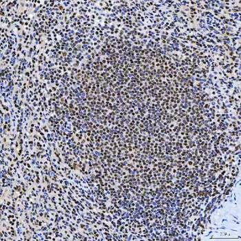 SNRNP200 Rabbit Polyclonal Antibody