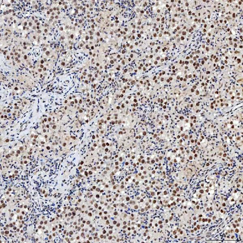 SNRNP200 Rabbit Polyclonal Antibody